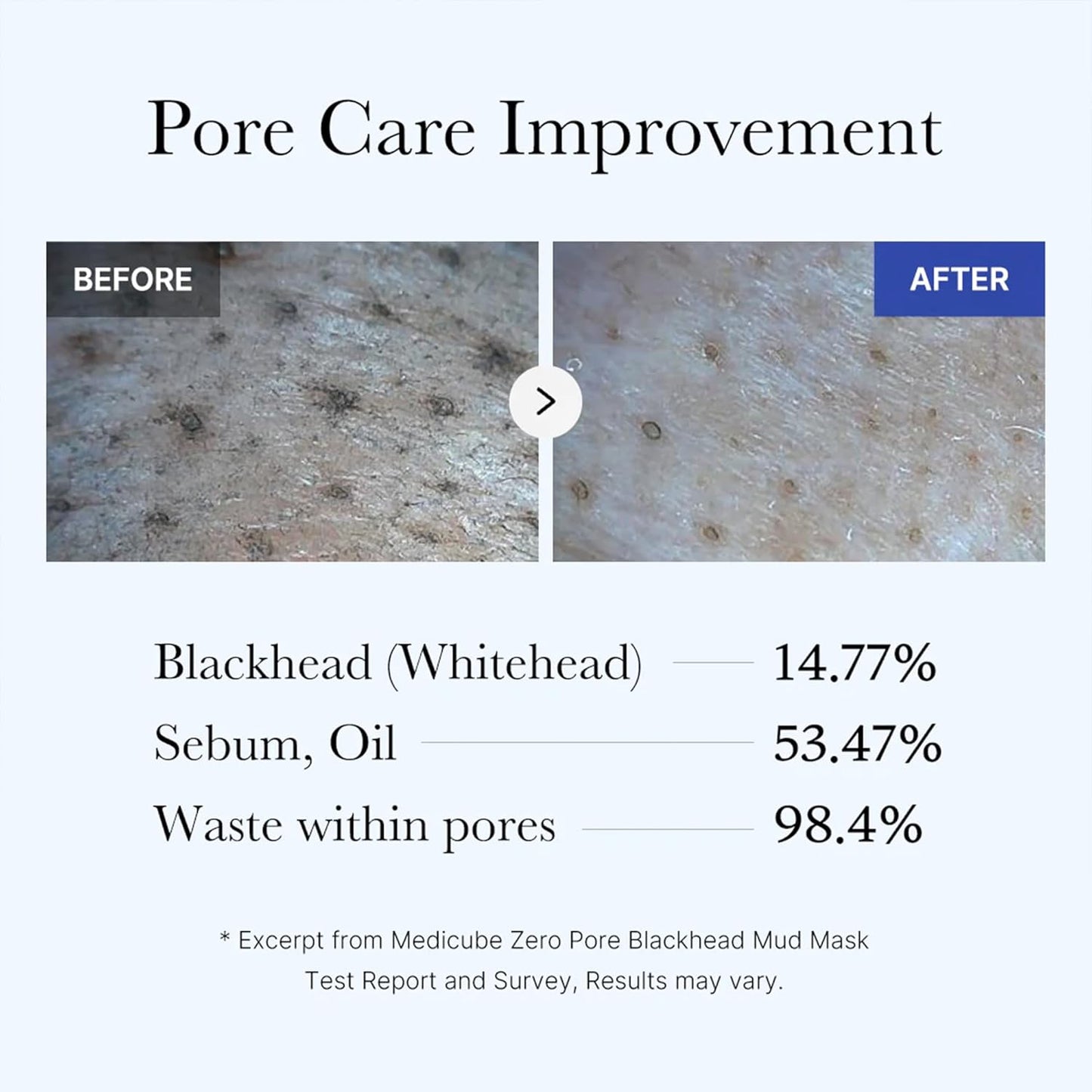 Medicube Zero Pore Blackhead Mud Mask — 3-Minute Deep Pore Cleanse | AHA BHA PHA + 5-Clay Formula | 100g