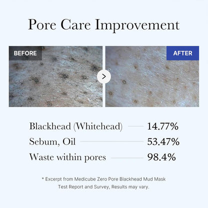 Medicube Zero Pore Blackhead Mud Mask — 3-Minute Deep Pore Cleanse | AHA BHA PHA + 5-Clay Formula | 100g