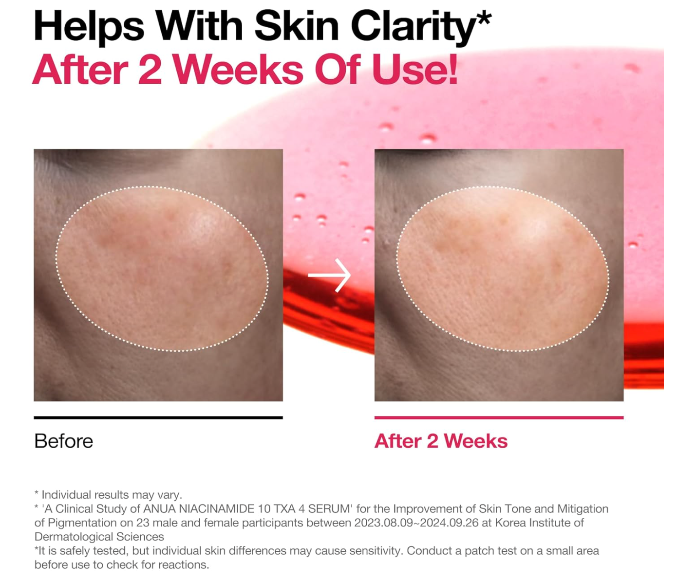 Anua Niacinamide 10 + TXA 4 Serum, Dark Spot Care, Hyaluronic Acid, Tranexamic Acid, Lightweight & Hydrating All-in-One Daily Facial Serum for Glass Skin, Korean Skincare, 1.01 fl.oz