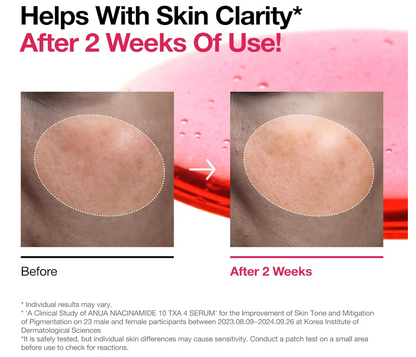 Anua Niacinamide 10 + TXA 4 Serum, Dark Spot Care, Hyaluronic Acid, Tranexamic Acid, Lightweight & Hydrating All-in-One Daily Facial Serum for Glass Skin, Korean Skincare, 1.01 fl.oz