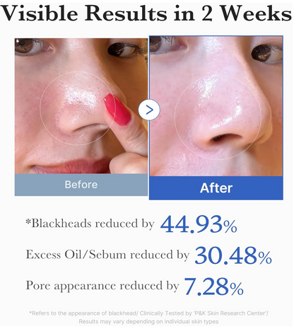 medicube Toner Pads Zero Pore Pad 2.0 | Dual-Textured Facial Pad for Exfoliation and Pore Care with 4.5% AHA Lactic Acid, 0.45% BHA Salicylic Acid | Ideal for All, Korean Skin Care, 70 Pads (1 Pack)