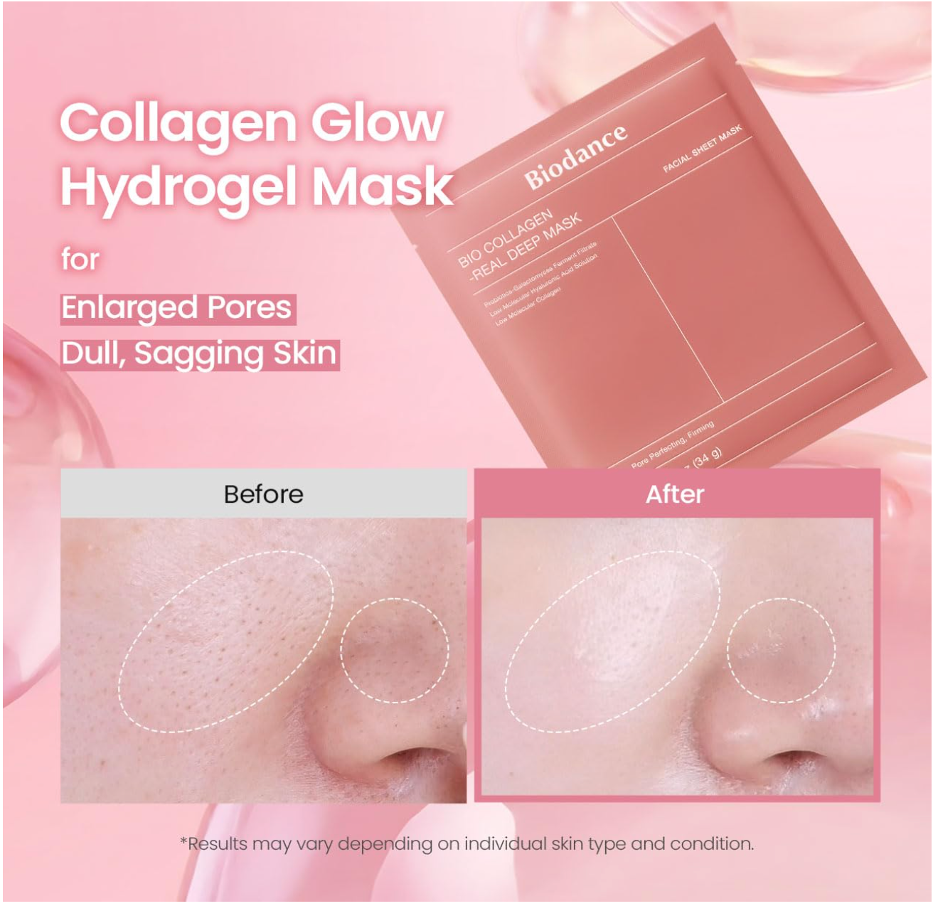 BIODANCE Bio-Collagen Real Deep Mask, Hydrating Overnight Hydrogel Mask, Pore Minimizing, Elasticity, Plumping Improvement, Korean Skin Care, Valentines Day Gifts for Her | 1.19oz(34g) x 4ea